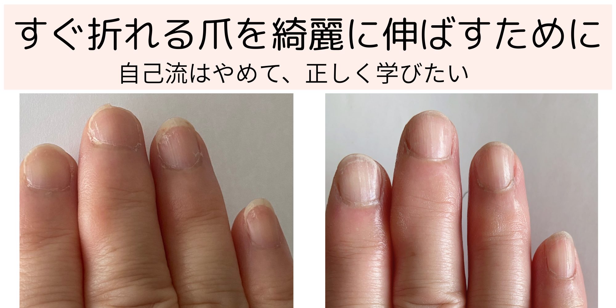 自己流卒業、やっと綺麗に伸ばせるように